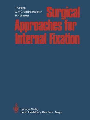 Surgical Approaches for Internal Fixation 1