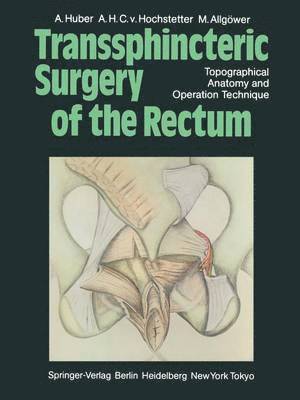 Transsphincteric Surgery of the Rectum 1