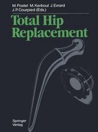 bokomslag Total Hip Replacement