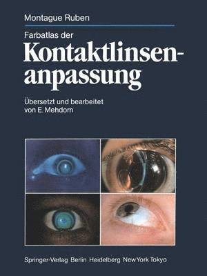 bokomslag Farbatlas der Kontaktlinsenanpassung