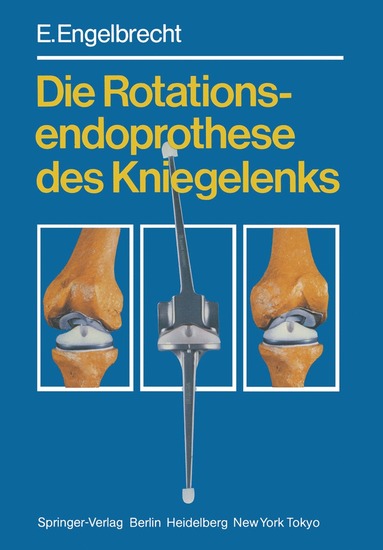 bokomslag Die Rotationsendoprothese des Kniegelenks