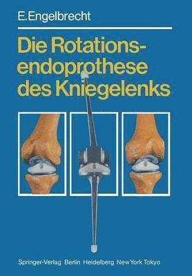 Die Rotationsendoprothese des Kniegelenks 1