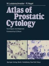bokomslag Atlas of Prostatic Cytology
