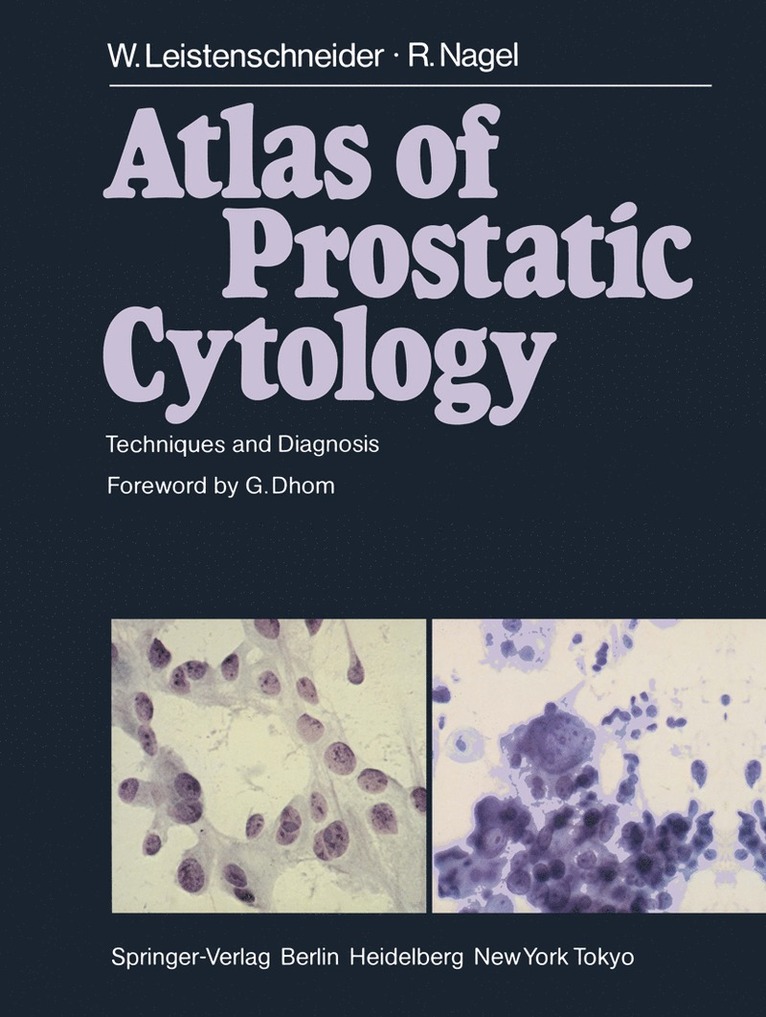 W. Leistenschneider, R. Nagel, W. Leistenschneider, R. Nagel - Atlas of Prostatic Cytology, Häftad