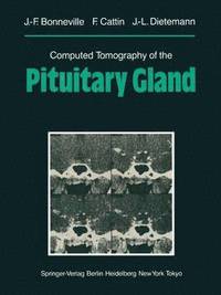 bokomslag Computed Tomography of the Pituitary Gland