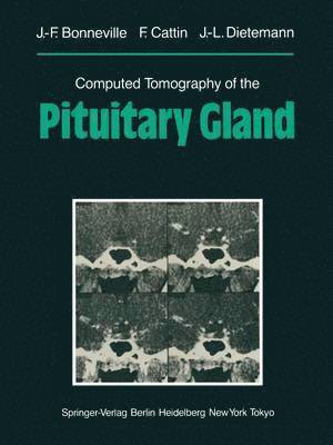 bokomslag Computed Tomography of the Pituitary Gland