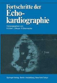 bokomslag Fortschritte der Echokardiographie
