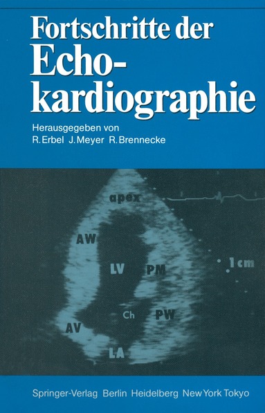 bokomslag Fortschritte der Echokardiographie