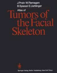 bokomslag Atlas of Tumors of the Facial Skeleton