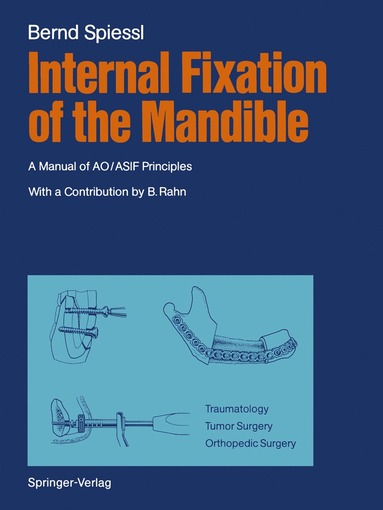 bokomslag Internal Fixation of the Mandible