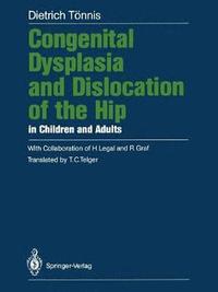 bokomslag Congenital Dysplasia and Dislocation of the Hip in Children and Adults