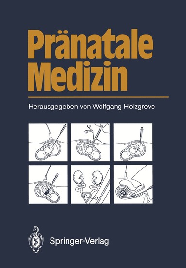 Wolfgang Holzgreve - Pränatale Medizin, Häftad