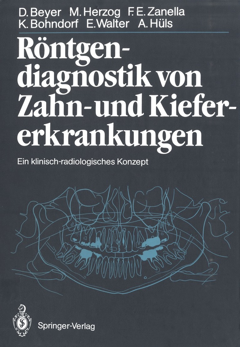 Dieter Beyer, Michael Herzog, Friedhelm Zanella, Klaus Bohndorf, Eberhard Walter, Alfons Hüls - Röntgendiagnostik von Zahn- und Kiefererkrankungen, Häftad