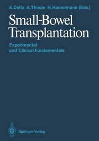bokomslag Small-Bowel Transplantation