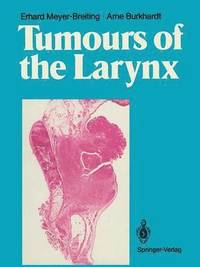 bokomslag Tumours of the Larynx