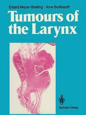 Tumours of the Larynx 1