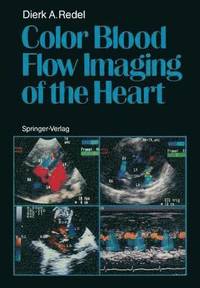 bokomslag Color Blood Flow Imaging of the Heart