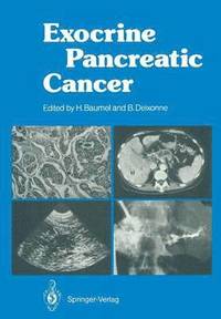 bokomslag Exocrine Pancreatic Cancer