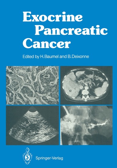 bokomslag Exocrine Pancreatic Cancer