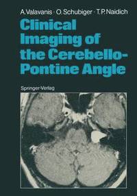 bokomslag Clinical Imaging of the Cerebello-Pontine Angle