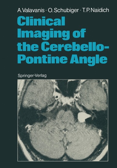 bokomslag Clinical Imaging of the Cerebello-Pontine Angle