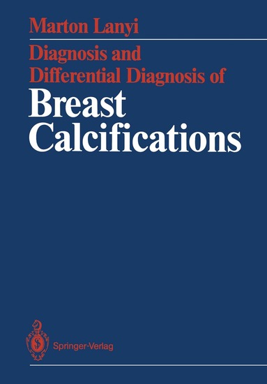 Marton Lanyi - Diagnosis and Differential Diagnosis of Breast Calcifications, Häftad