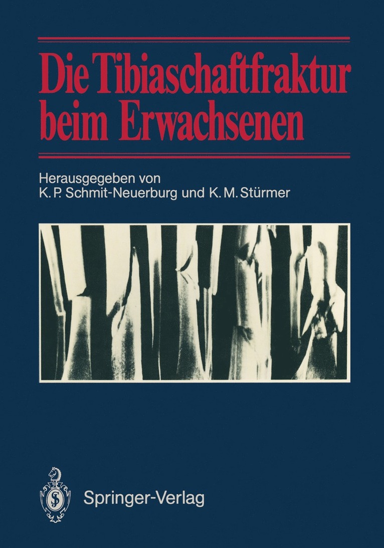 K.P. Schmit-Neuerburg, K.M. Stürmer, K. P. Schmit-Neuerburg, K. M. Stürmer - Die Tibiaschaftfraktur beim Erwachsenen, Häftad