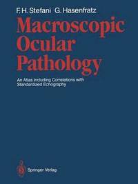 bokomslag Macroscopic Ocular Pathology