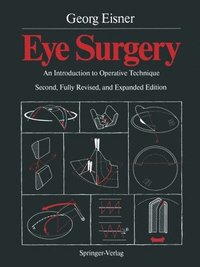 bokomslag Eye Surgery