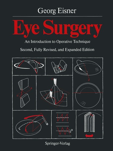 Georg Eisner - Eye Surgery, Häftad