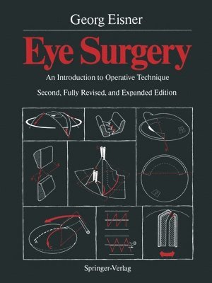 Georg Eisner - Eye Surgery, Häftad
