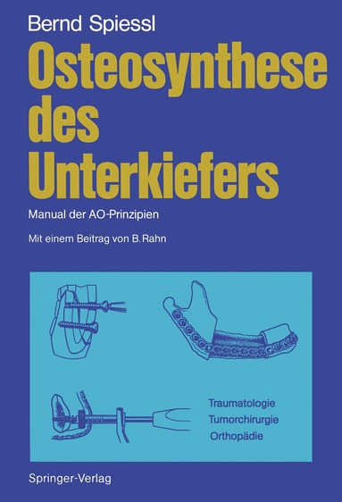 bokomslag Osteosynthese des Unterkiefers