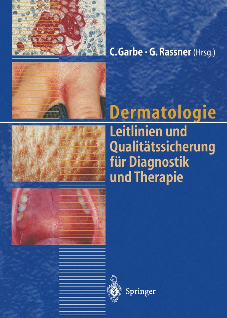 C. Garbe, G. Rassner - Dermatologie, Häftad