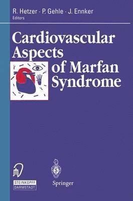 Cardiovascular Aspects of Marfan Syndrome 1