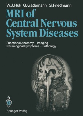 Magnetic Resonance Imaging of Central Nervous System Diseases 1