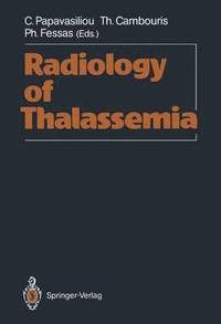 bokomslag Radiology of Thalassemia