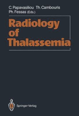 Radiology of Thalassemia 1