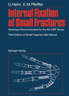 bokomslag Internal Fixation of Small Fractures