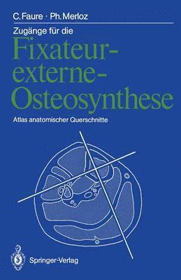 Zugnge fr die Fixateur-externe-Osteosynthese 1