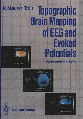 Konrad Maurer - Topographic Brain Mapping of EEG and Evoked Potentials, Häftad