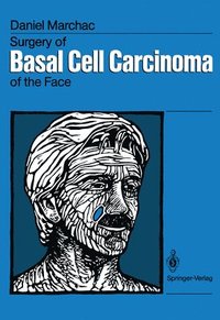 bokomslag Surgery of Basal Cell Carcinoma of the Face