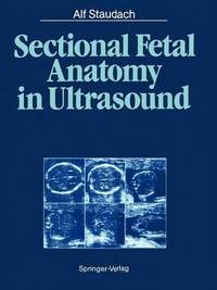 bokomslag Sectional Fetal Anatomy in Ultrasound
