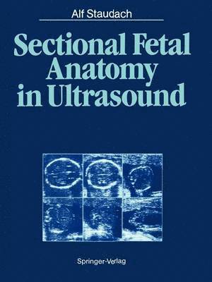 Alf Staudach, Bernd K. Wittmann - Sectional Fetal Anatomy in Ultrasound, Häftad