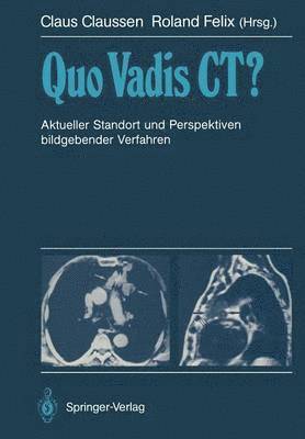 Claus Claussen, Roland Felix - Quo Vadis CT?, Häftad