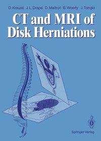 bokomslag CT and MRI of Disk Herniations