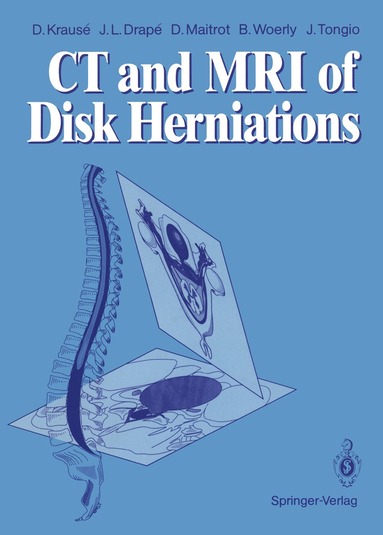 bokomslag CT and MRI of Disk Herniations