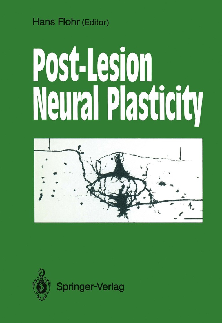 Hans Flohr - Post-Lesion Neural Plasticity, Häftad