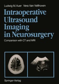 bokomslag Intraoperative Ultrasound Imaging in Neurosurgery