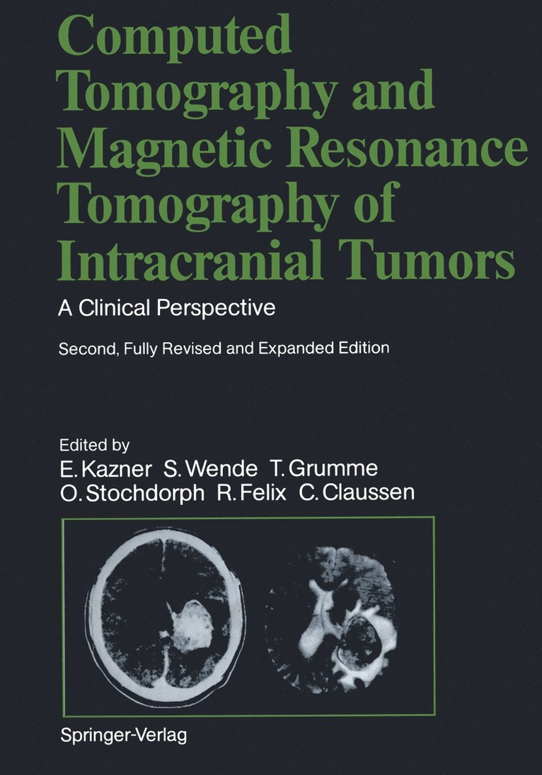 Computed Tomography and Magnetic Resonance Tomography of Intracranial Tumors 1