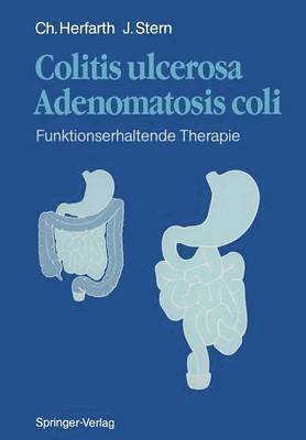 bokomslag Colitis ulcerosa - Adenomatosis coli